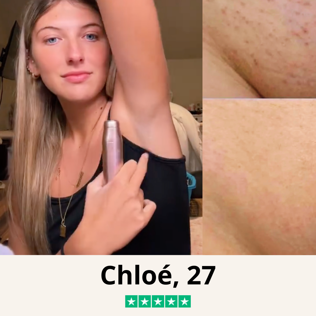 Tondeuse Bikini - Édition Limitée ☀️