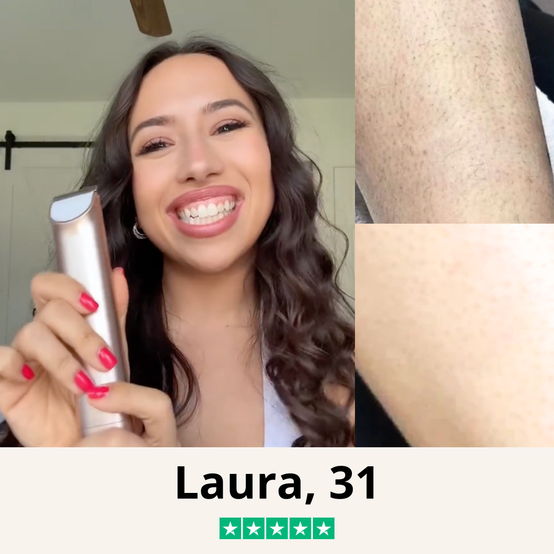 Tondeuse Bikini - Édition Limitée ☀️